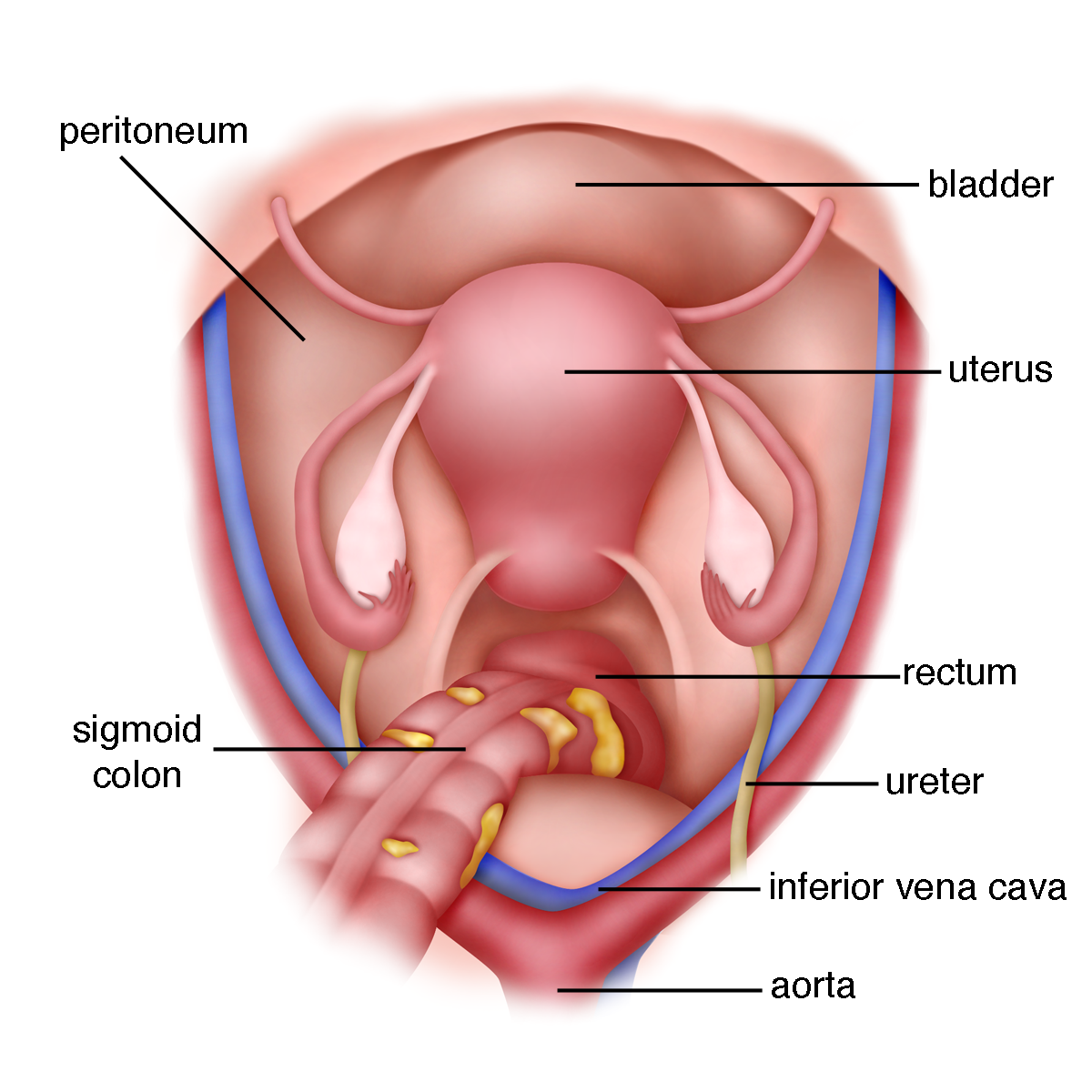 Uterus merupakan organ reproduksi wanita. yang berfungsi sebagai