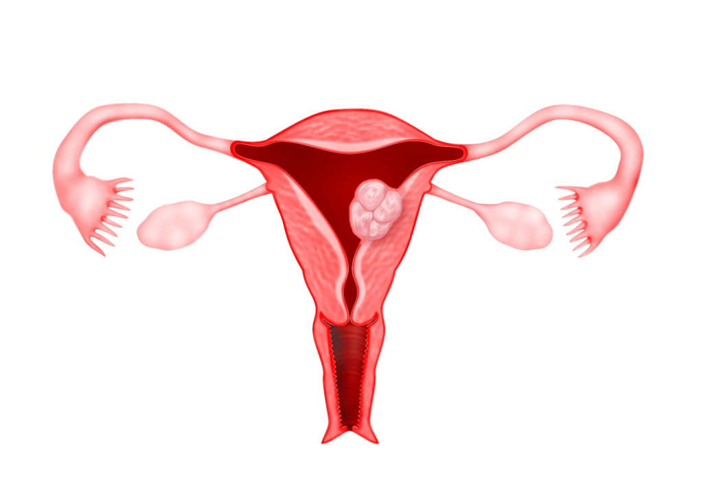 Spirale vagina